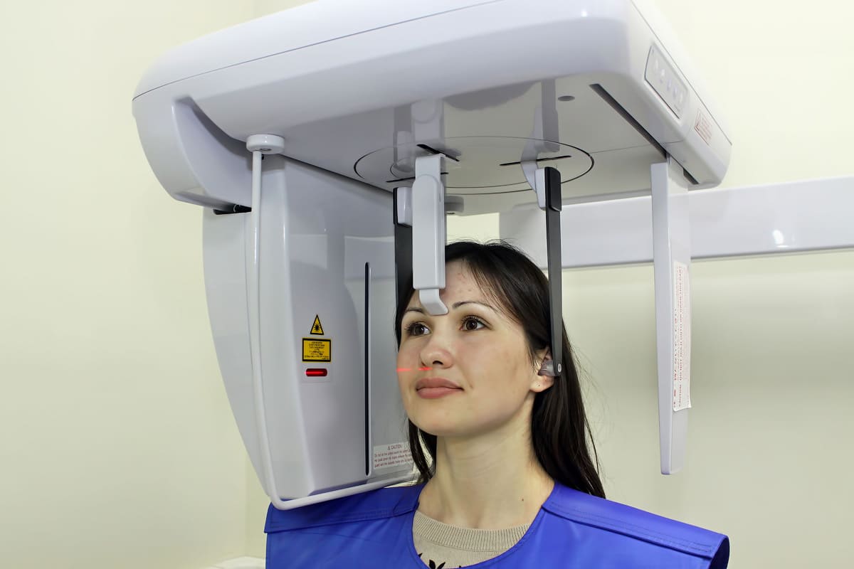 Процедура рентгену черепа у Вінниці