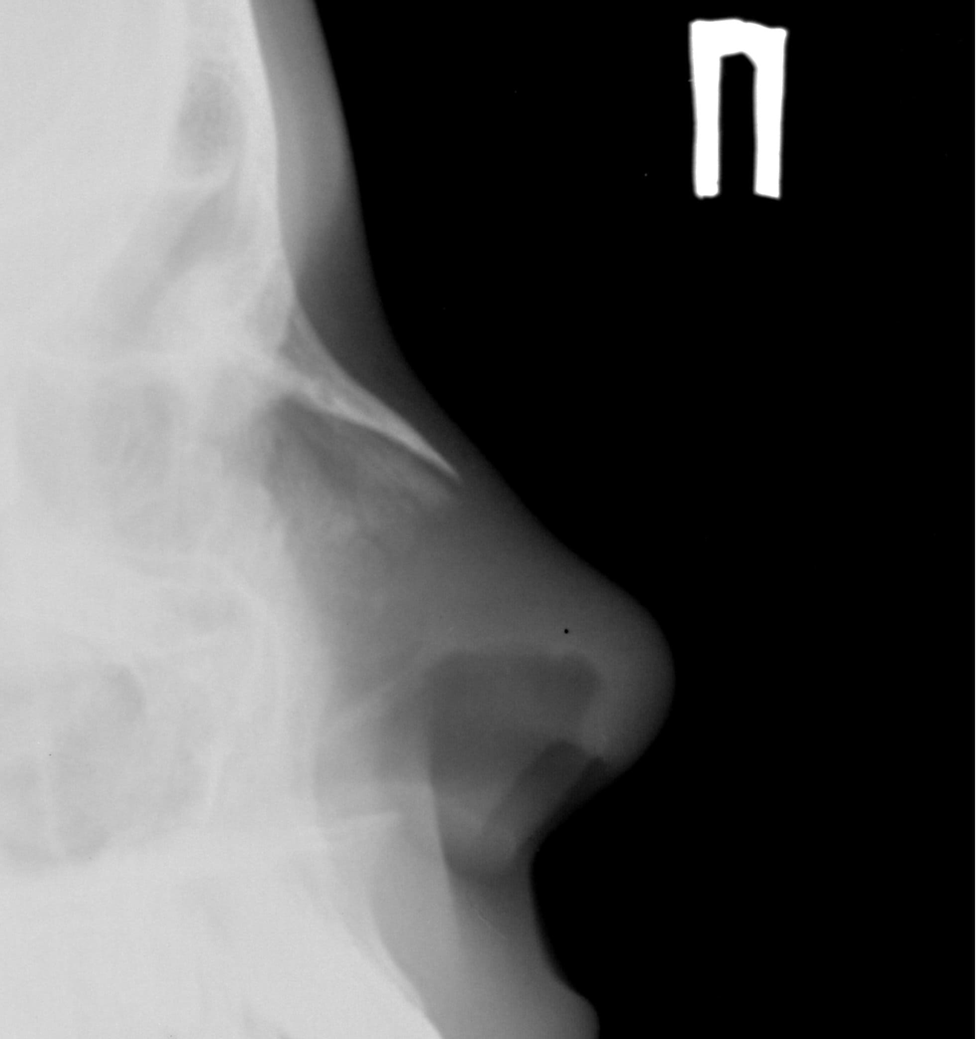 Рентген носа в Виннице, ВинАльфа-Мед