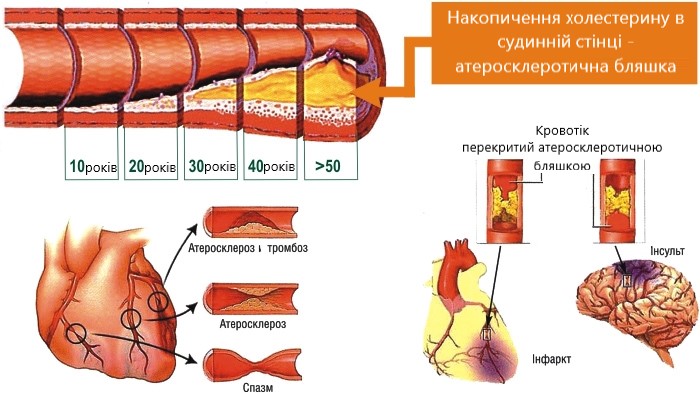Патології судин шиї